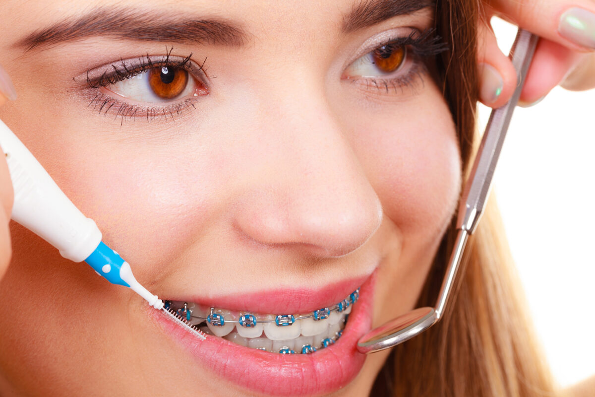 How to clean braces effectively