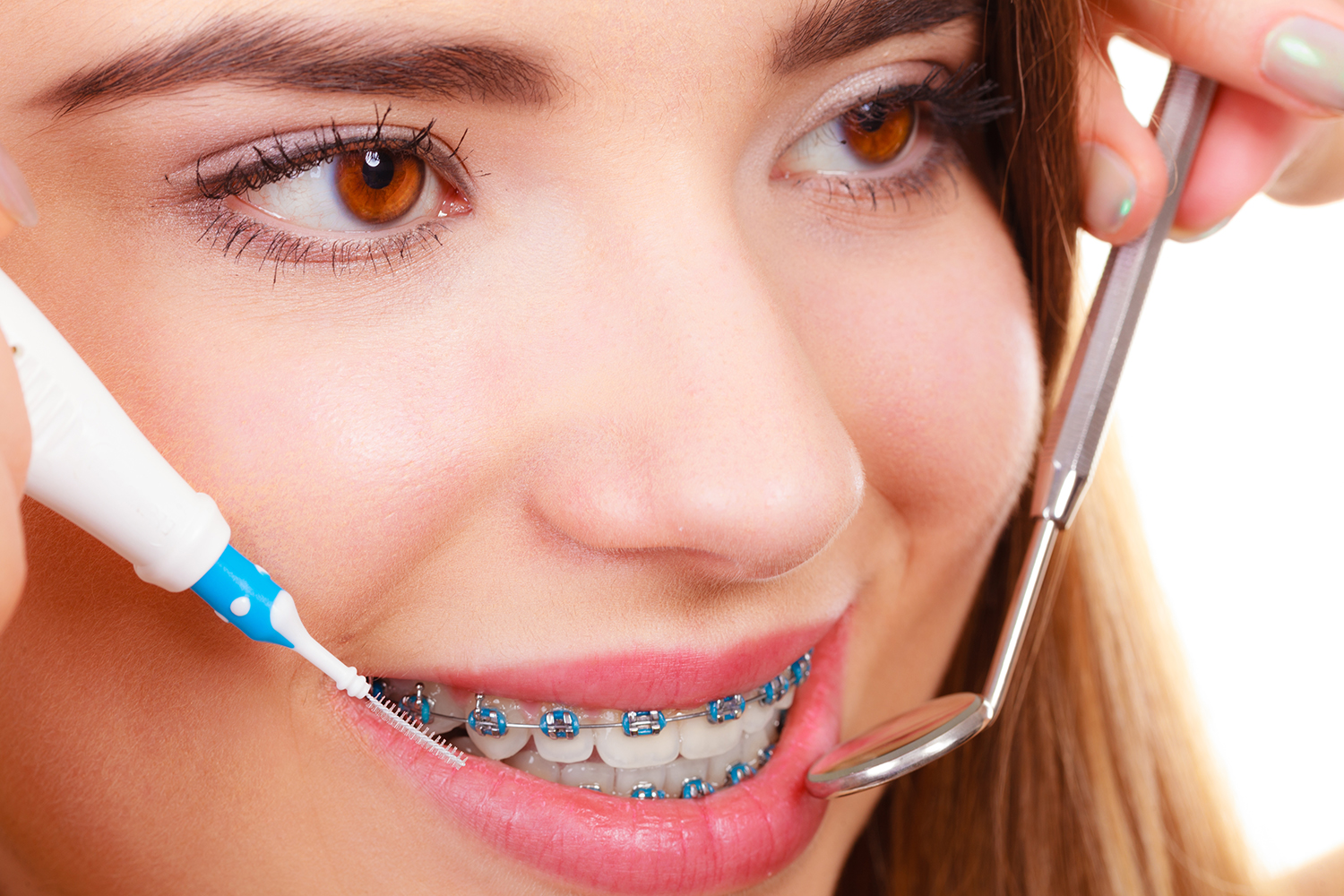 Cleaning Your Braces and Teeth Properly