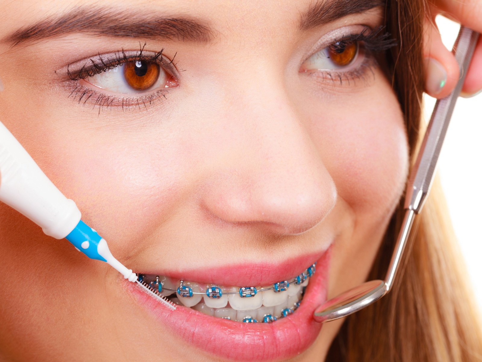 Can braces change your voice?