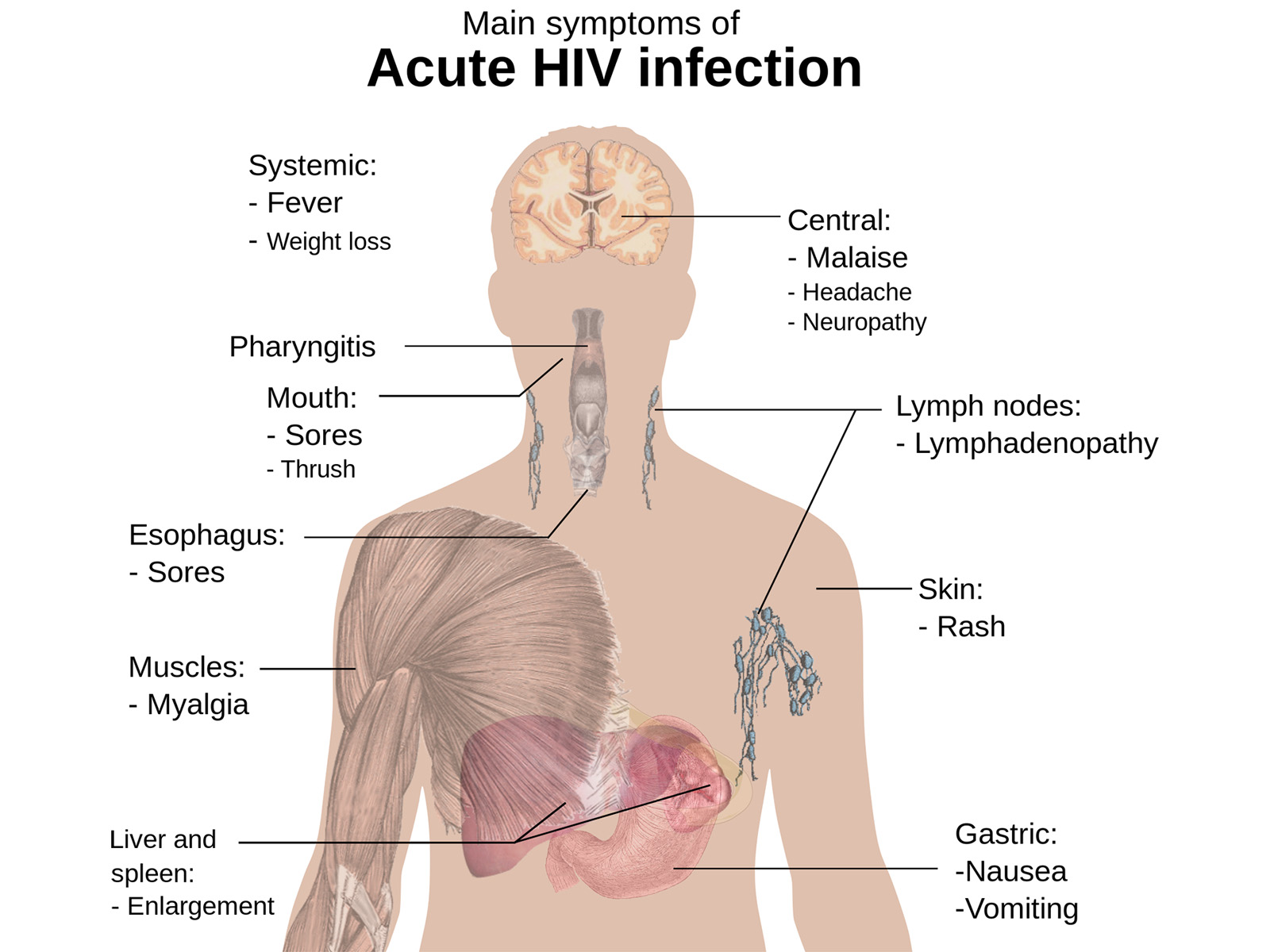 How Does HIV/AIDS Affect the Mouth?