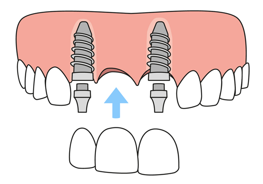 78621 TX Dentist