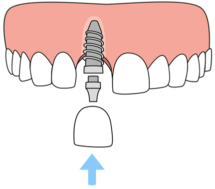 Dentist in 78621 TX