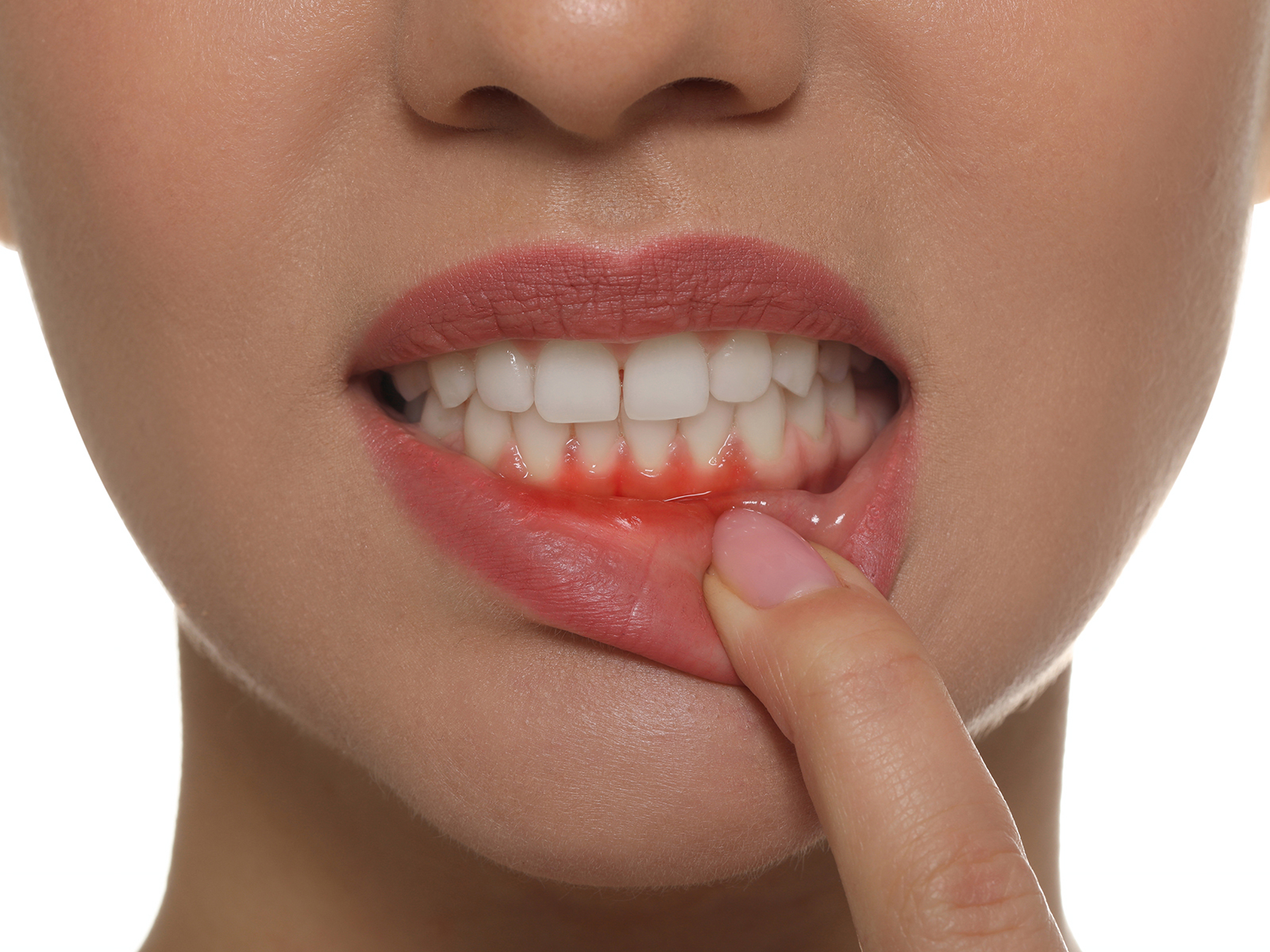 Which Vitamin Deficiency Causes Gum Problems?