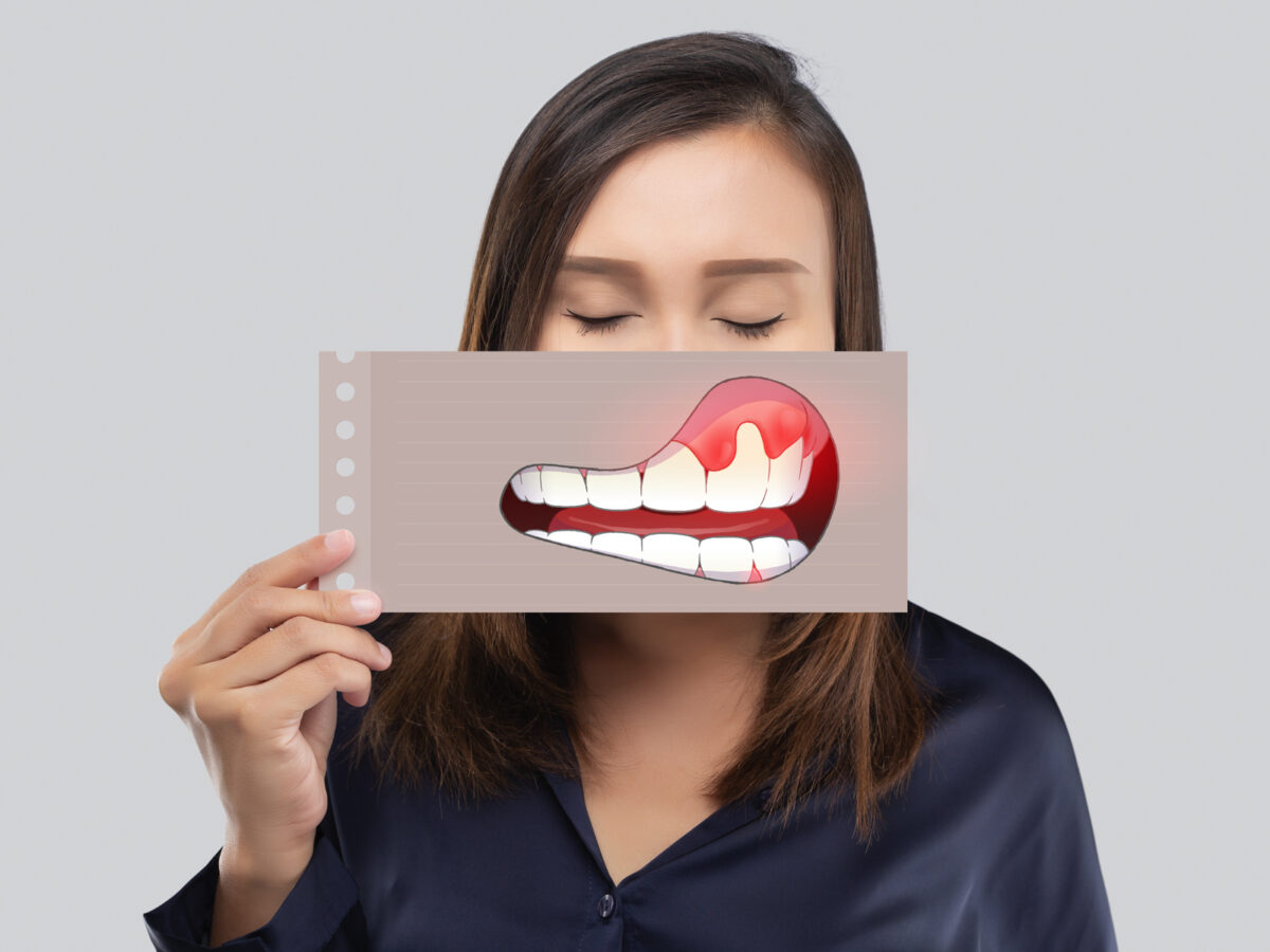 The Effects Of Periodontal Disease On Your Smile