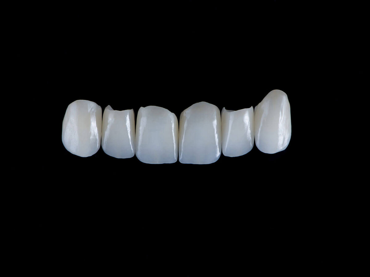 Dental crowns