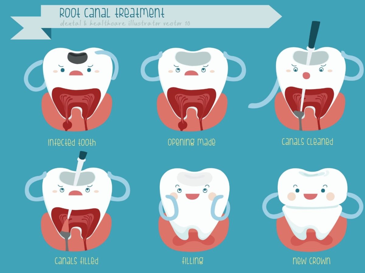 Managing Post-Root Canal Pain: Tips For A Smooth Recovery