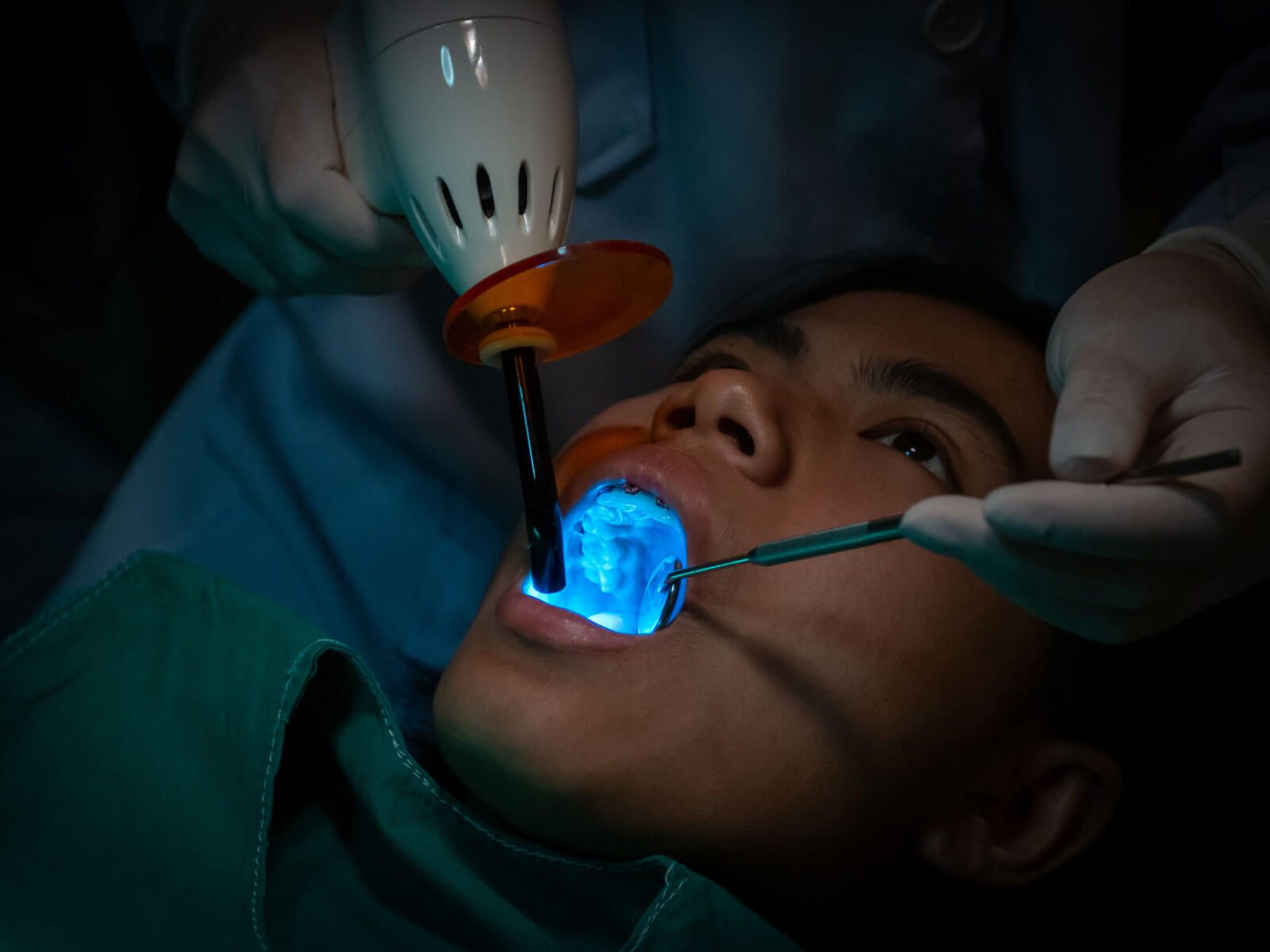 What Is Biomimetic Dentistry?: A Guide to Tooth-Preserving Restorative Techniques and Benefits