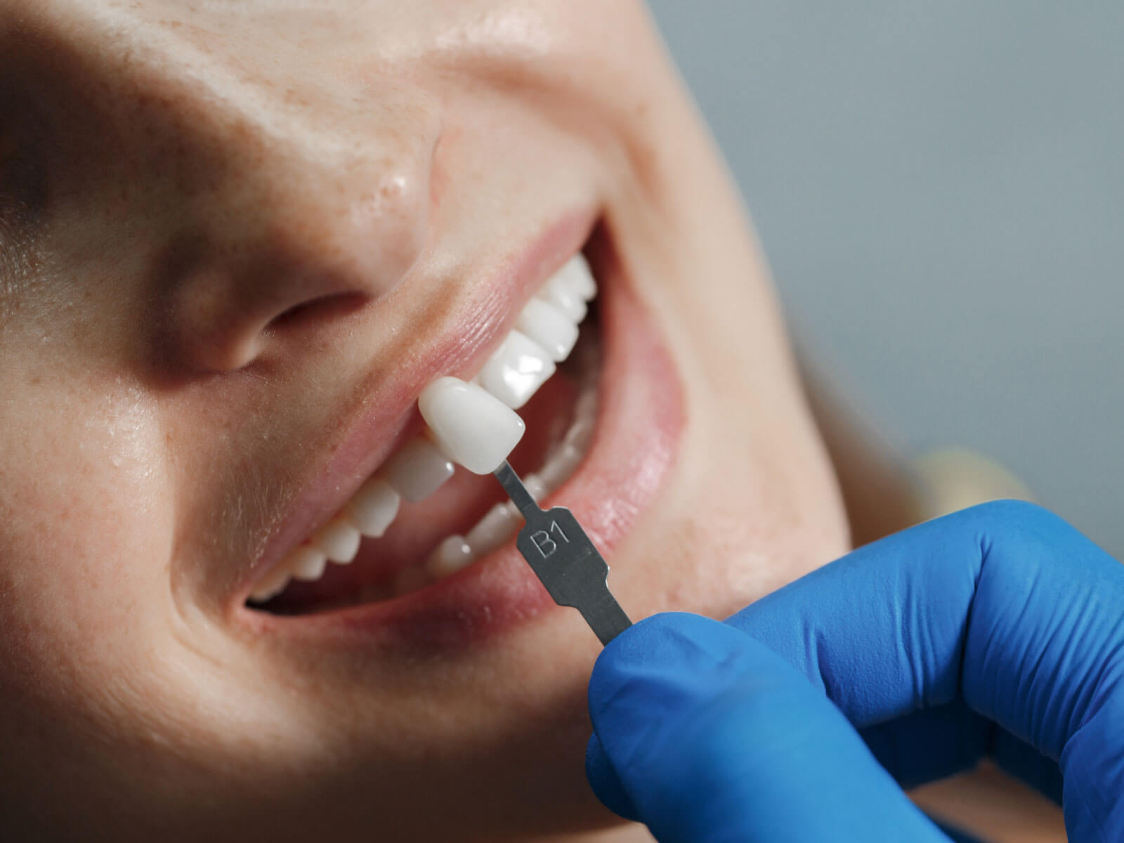 Dental Implant Cost in Elgin, TX: 2026 Pricing Guide
